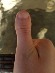 Stubby thumb